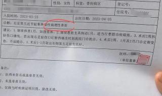 骨折10级伤残赔偿价格表